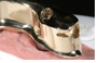 implantat-prothese-abn_6_.jpg