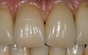 implantat-prothese-fest_20_.jpg